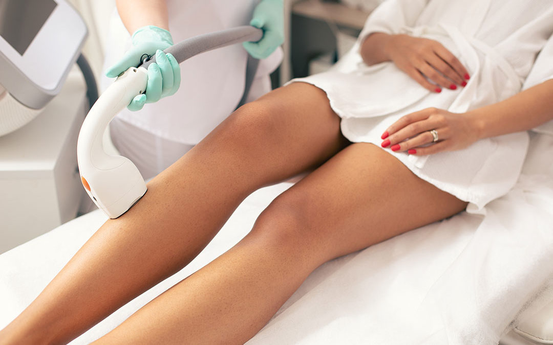 How permanent is laser hair removal? - Avance Clinic